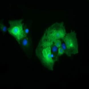 anti-CD19 Molecule (CD19) antibody avatar