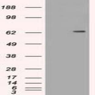 anti-CD19 Molecule (CD19) antibody avatar