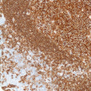 anti-CD19 Molecule (CD19) (C-Term) antibody avatar