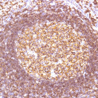 anti-CD19 Molecule (CD19) (C-Term) antibody avatar