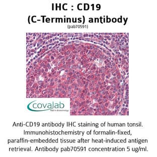anti-CD19 Molecule (CD19) (C-Term) antibody avatar