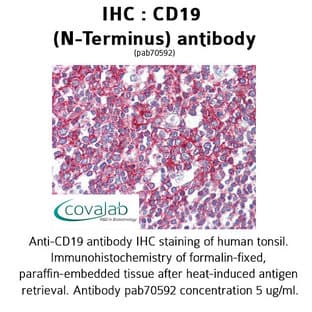 anti-CD19 Molecule (CD19) (N-Term) antibody avatar