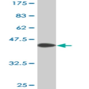 anti-CD19 Molecule (CD19) (AA 98-187) antibody avatar