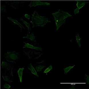 anti-CD19 Molecule (CD19) (AA 98-187) antibody avatar