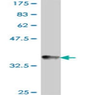 anti-CD19 Molecule (CD19) (AA 98-187) antibody avatar