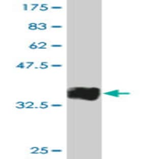 anti-CD19 Molecule (CD19) (AA 98-187) antibody avatar