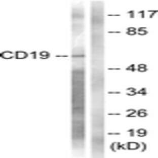anti-CD19 Molecule (CD19) (AA 501-550) antibody avatar