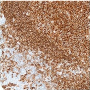 anti-CD19 Molecule (CD19) (C-Term) antibody avatar