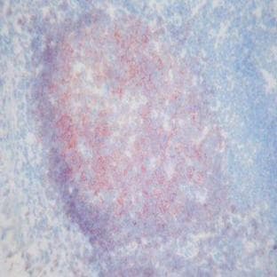 anti-CD19 Molecule (CD19) antibody avatar