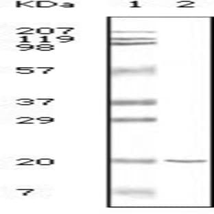 anti-CD19 Molecule (CD19) antibody avatar