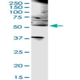 anti-CD19 Molecule (CD19) (AA 1-556) antibody avatar