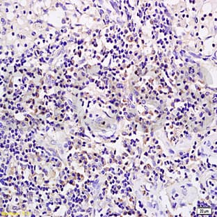 anti-CD19 Molecule (CD19) antibody avatar