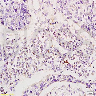 anti-CD19 Molecule (CD19) (pTyr531) antibody avatar