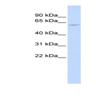 anti-5'-Nucleotidase, Cytosolic IB (NT5C1B) (N-Term) antibody avatar