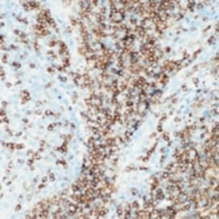 anti-CD22 Molecule (CD22) antibody avatar