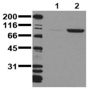 anti-CD22 Molecule (CD22) (pTyr1150), (pTyr1151) antibody avatar