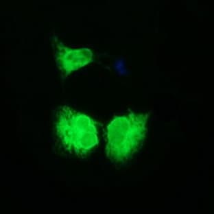 anti-CD163 Molecule (CD163) antibody