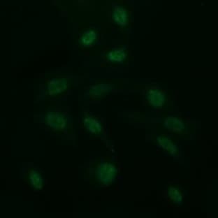 anti-CD163 Molecule (CD163) antibody