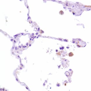 anti-CD163 Molecule (CD163) (N-Term) antibody avatar