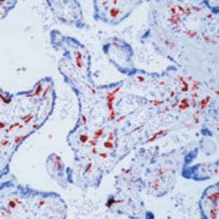 anti-CD163 Molecule (CD163) antibody avatar