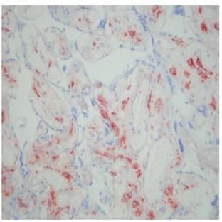 anti-CD163 Molecule (CD163) antibody avatar