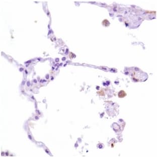 anti-CD163 Molecule (CD163) antibody avatar