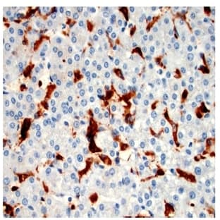 anti-CD163 Molecule (CD163) antibody avatar