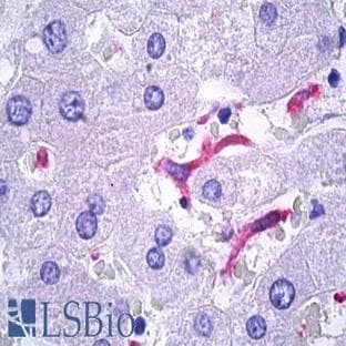 anti-CD163 Molecule (CD163) antibody avatar