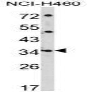 anti-Cerberus 1, Cysteine Knot Superfamily, Homolog (Xenopus Laevis) (CER1) (N-Term) antibody avatar