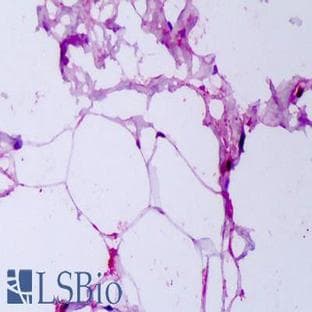 anti-Adiponectin, C1Q and Collagen Domain Containing (ADIPOQ) antibody avatar