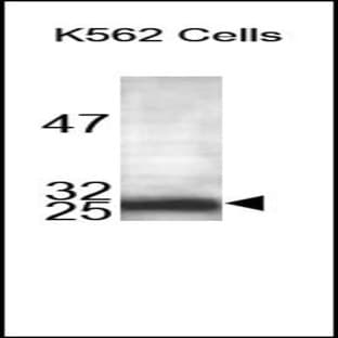 anti-Adiponectin, C1Q and Collagen Domain Containing (ADIPOQ) (C-Term) antibody avatar