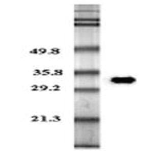 anti-Adiponectin, C1Q and Collagen Domain Containing (ADIPOQ) antibody avatar