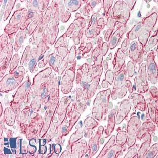 anti-Adiponectin, C1Q and Collagen Domain Containing (ADIPOQ) (C-Term) antibody avatar