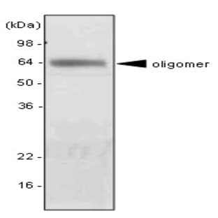 anti-Adiponectin, C1Q and Collagen Domain Containing (ADIPOQ) antibody avatar