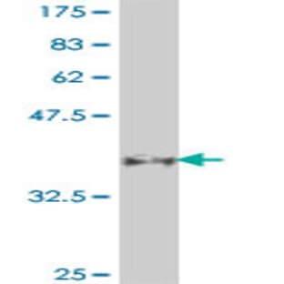 anti-Adiponectin, C1Q and Collagen Domain Containing (ADIPOQ) (AA 111-210) antibody avatar