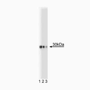 anti-Adiponectin, C1Q and Collagen Domain Containing (ADIPOQ) (AA 1-247) antibody avatar