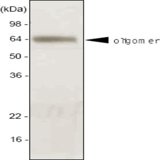 anti-Adiponectin, C1Q and Collagen Domain Containing (ADIPOQ) (AA 15-244) antibody avatar