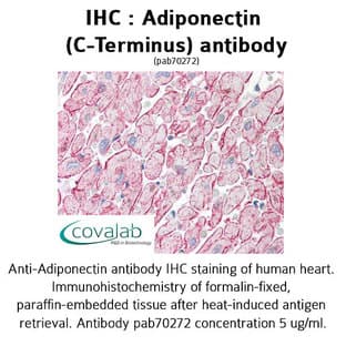 anti-Adiponectin, C1Q and Collagen Domain Containing (ADIPOQ) (C-Term) antibody avatar