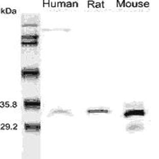 anti-Adiponectin, C1Q and Collagen Domain Containing (ADIPOQ) antibody avatar