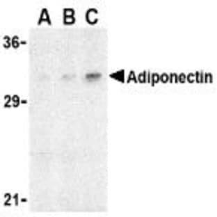 anti-Adiponectin, C1Q and Collagen Domain Containing (ADIPOQ) antibody avatar