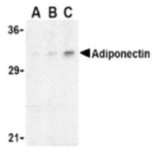 anti-Adiponectin, C1Q and Collagen Domain Containing (ADIPOQ) (N-Term) antibody avatar