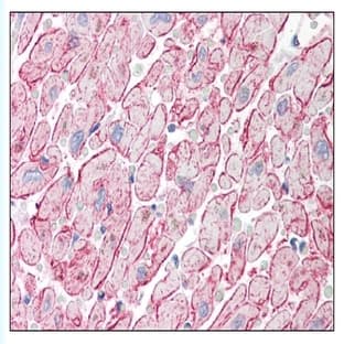 anti-Adiponectin, C1Q and Collagen Domain Containing (ADIPOQ) (C-Term) antibody avatar
