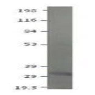 anti-Adiponectin, C1Q and Collagen Domain Containing (ADIPOQ) (C-Term), (Globular Domain), (AA 198-218) antibody avatar