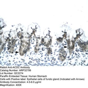 anti-Adiponectin, C1Q and Collagen Domain Containing (ADIPOQ) (N-Term) antibody avatar