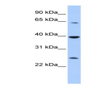anti-Cytosolic Iron-Sulfur Protein Assembly 1 (CIAO1) (Middle Region) antibody avatar