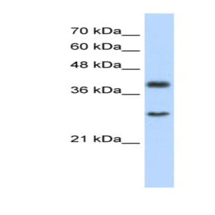 anti-Cytosolic Iron-Sulfur Protein Assembly 1 (CIAO1) (C-Term) antibody avatar