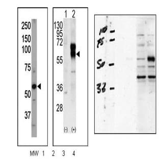 anti-Activin A Receptor Type II-Like 1 (ACVRL1) (N-Term) antibody avatar