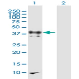 anti-CD28 (CD28) (AA 1-220) antibody avatar