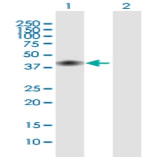 anti-CD28 (CD28) (AA 1-220) antibody avatar