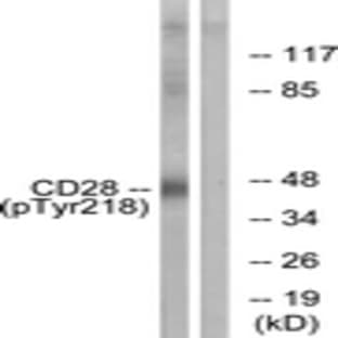 anti-CD28 (CD28) (pTyr218) antibody avatar